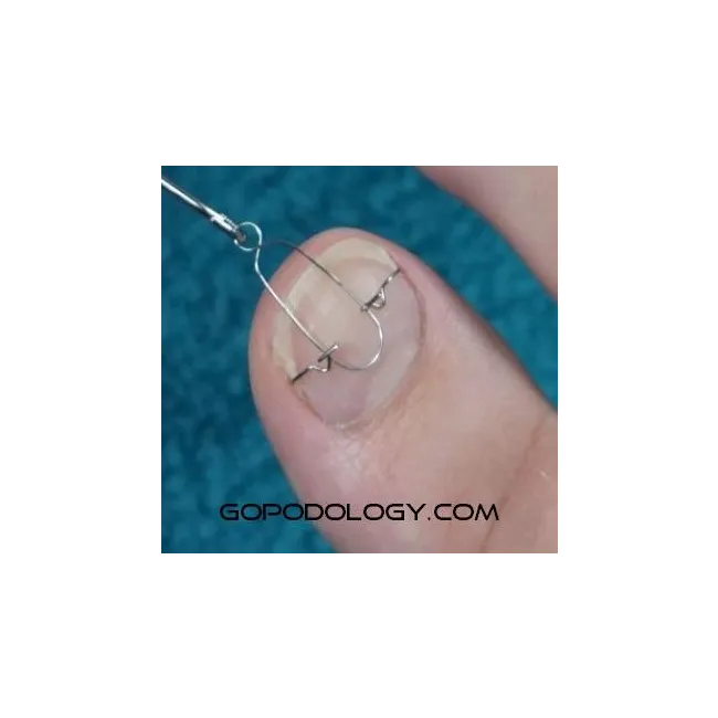 Batık Tırnak Ana Teli Sağ-Sol Çift Ø: 0,40 mm (10 Çift)