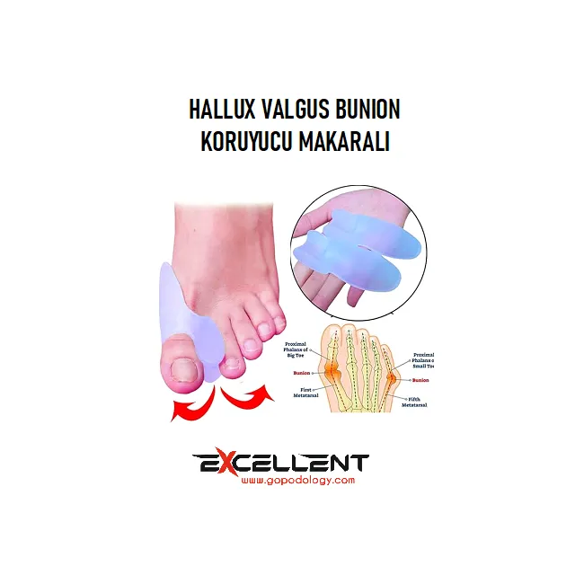 HALLUX VALGUS BUNION KORUYUCU MAKARALI BEYAZ (ÇİFT)