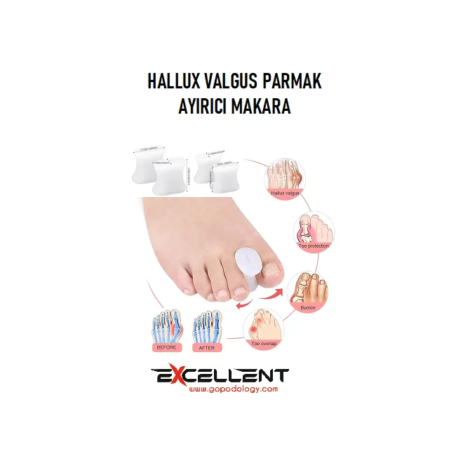 HALLUX VALGUS PARMAK AYIRICI MAKARA TEN RENGİ (ÇİFT)