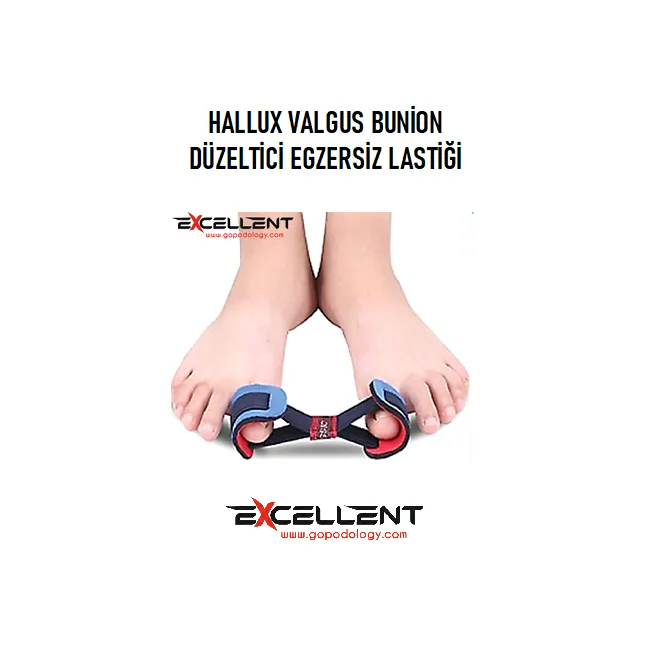 HALLUX VALGUS BUNİON DÜZELTİCİ EGZERSİZ LASTİĞİ (1 ADET)